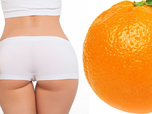 Mga pamamaraan para sa pag-alis ng cellulite