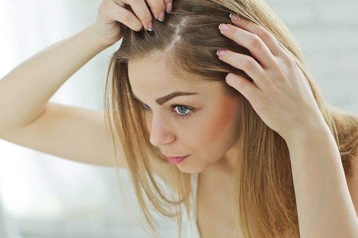 Perte de cheveux