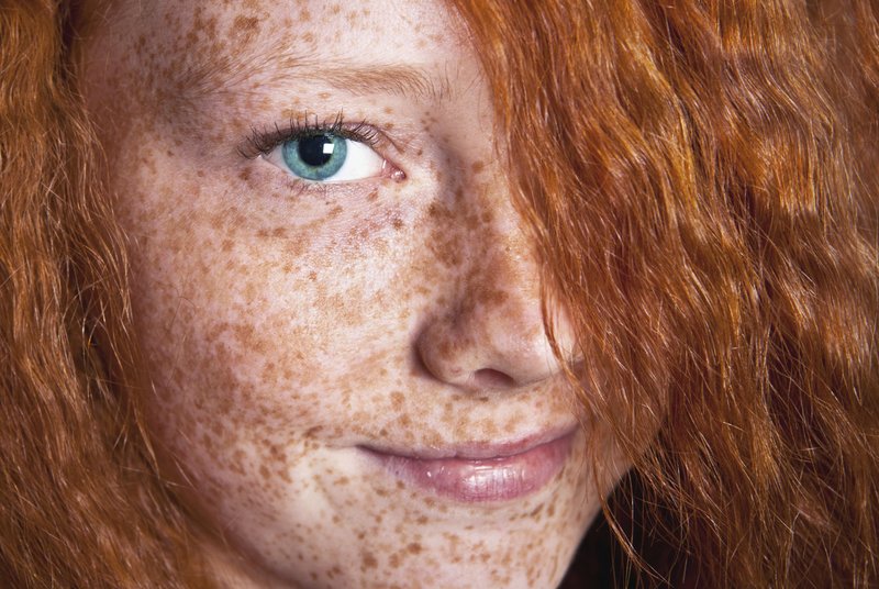 Batang babae na may mga freckles sa kanyang mukha.