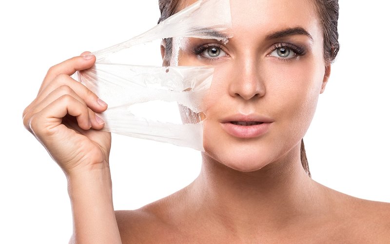 Avantages et inconvénients de peeling prx-t33