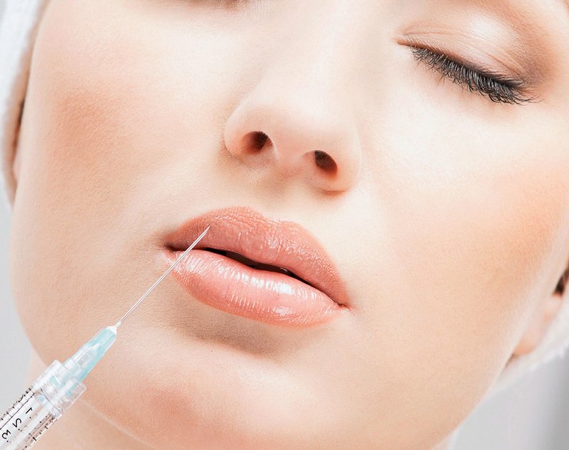 Hyaluronic Acid Injection