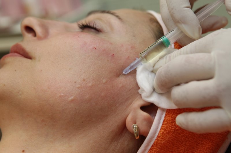 Administration de drogues injectables